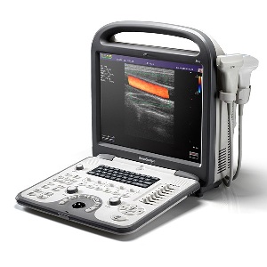 Портативный цветной цифровой ультразвуковой диагностическая сканер S6 SonoScape