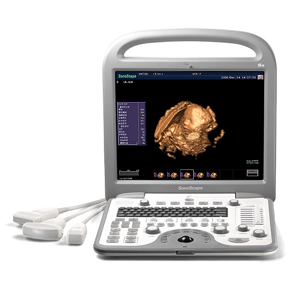 Ультразвуковой сканер S8, цветной, портативный, Sonoscape
